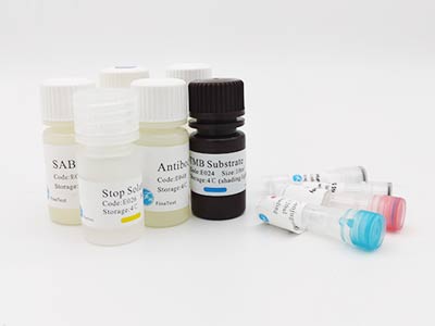 綿羊基質(zhì)金屬蛋白酶抑制因子1(TIMP-1)酶聯(lián)免疫(elisa)試劑盒