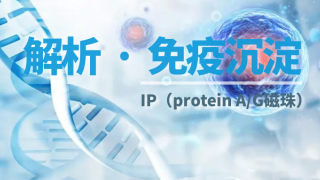 免疫沉淀（IP）實驗7大常見問題及解決方案